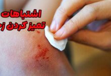 اشتباهات در تمیز کردن زخم