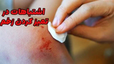اشتباهات در تمیز کردن زخم
