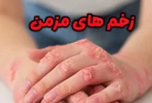 زخم مزمن