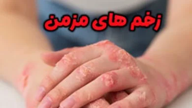 زخم مزمن