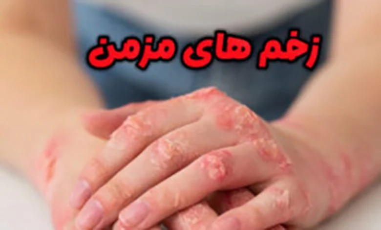 زخم مزمن