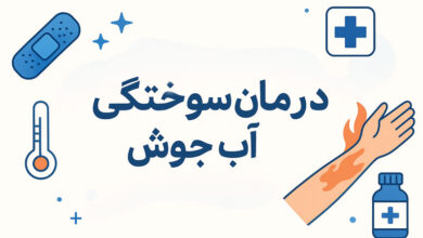 درمان زخم سوختگی آب جوش