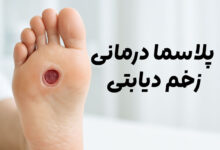 پلاسما درمانی زخم دیابتی