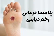 پلاسما درمانی زخم دیابتی