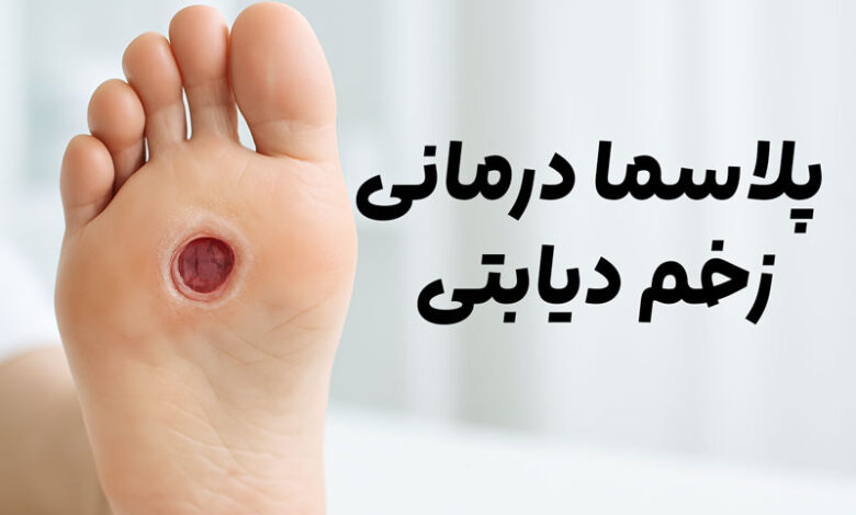 پلاسما درمانی زخم دیابتی