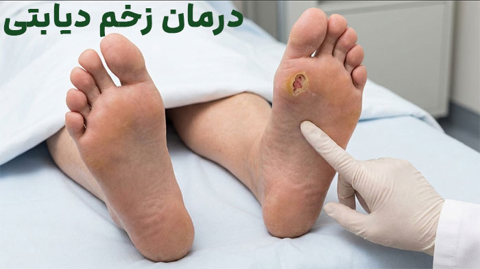 درمان-زخم-دیابتی