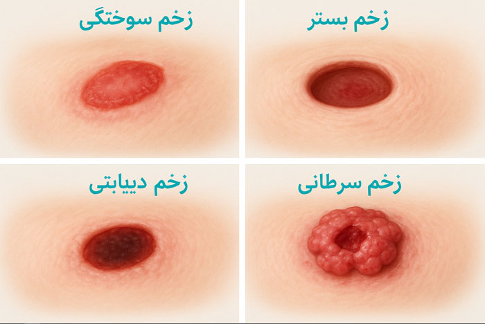 خدمات ویژه کلینیک زخم در سعادت آباد برای بیماران دیابتی